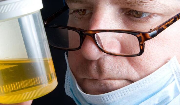 Urinanalyse auf chronische Prostatitis